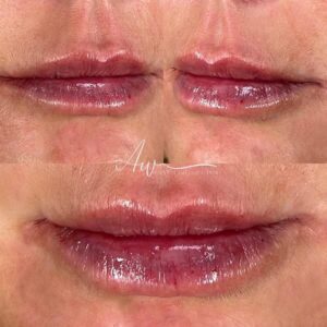 mind body and soul medical 3 lip close-ups