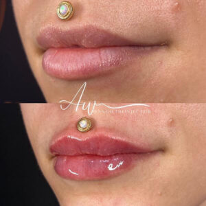 mind body and soul medical full lips with gold piercing