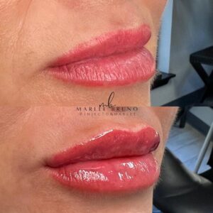 mind body and soul medical plump lips