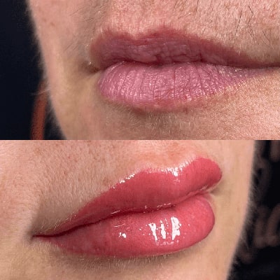 Lip blushing before and after - 01