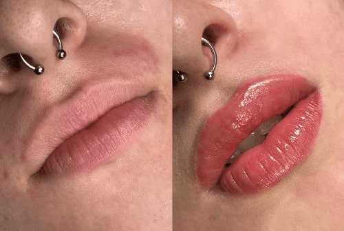 Lip blushing before and after - 02