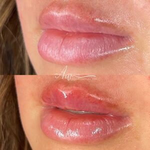 Lip blushing before and after - 03