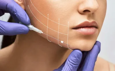 How PDO Threads Stimulate Collagen Production for Long-Lasting Results